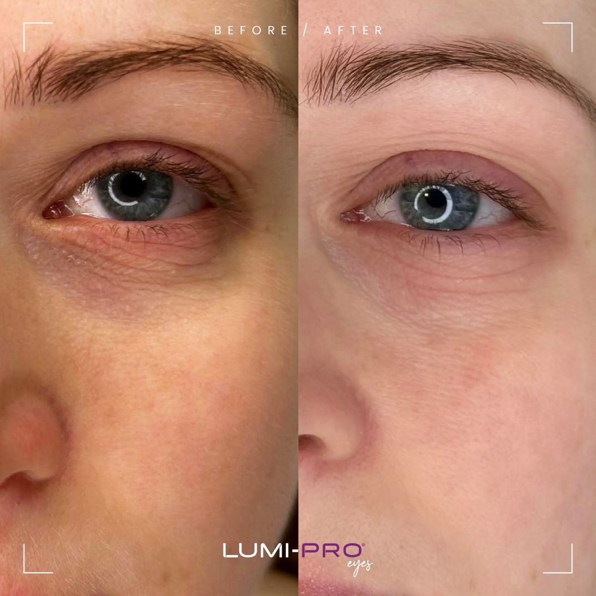 Lumi eyes бустер — 2
